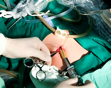 Specialized for laparoscopic instrument cables