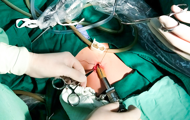 Specialized for laparoscopic instrument cables