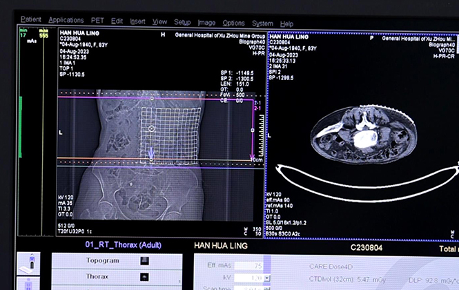 Radiopaque Positioning and Marking Aids