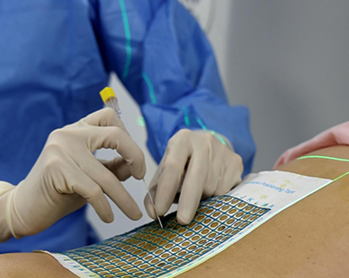 Disposable Sterile Radiopague  Positioning and Marking Aids
